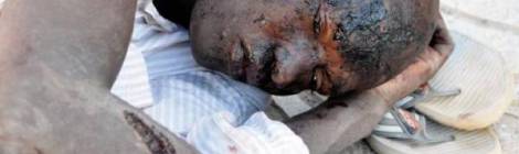 Estado en que quedó uno de los afectados por el ataque