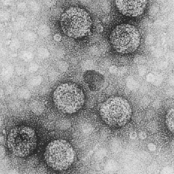 Virus del mosaico de la coliflor